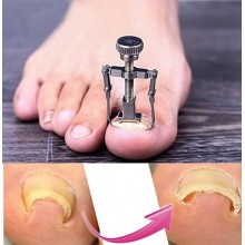 protiv uraslih noktiju